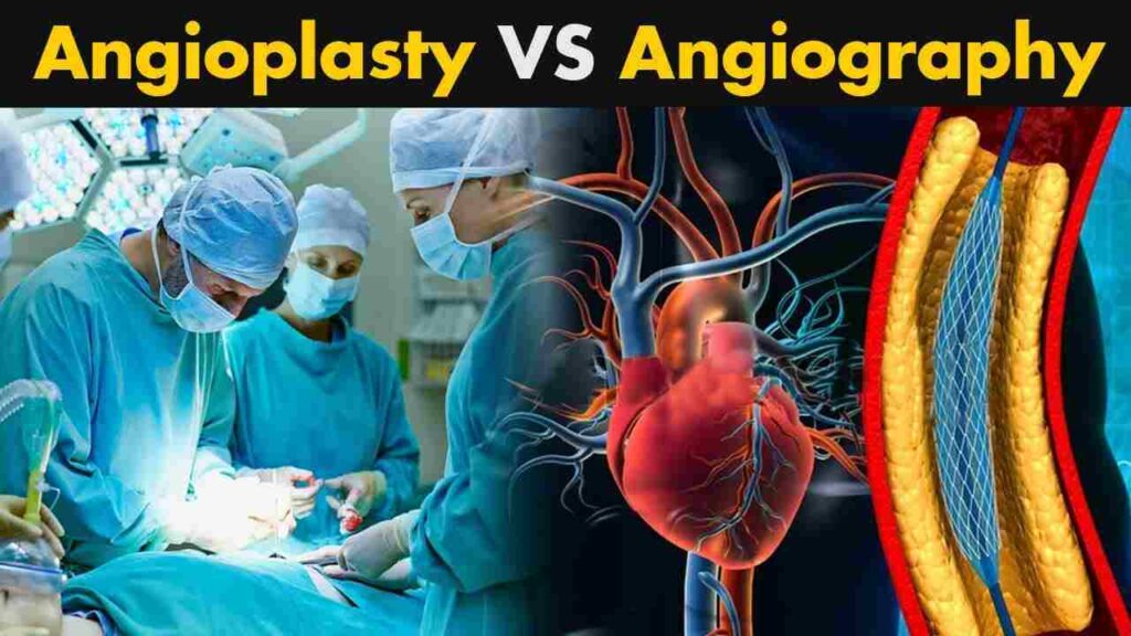 Explore 15 Key Difference between Angiography and Angioplasty poster